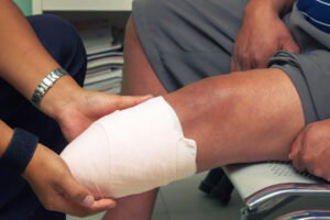 Image of man sitting with recently amputated leg